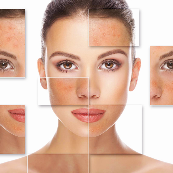 VISO TRATTAMENTI SPECIFICI